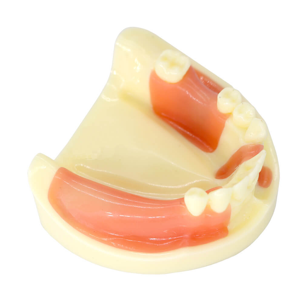 Dental Implant Training Model with Missing Teeth & Bone Loss Simulation