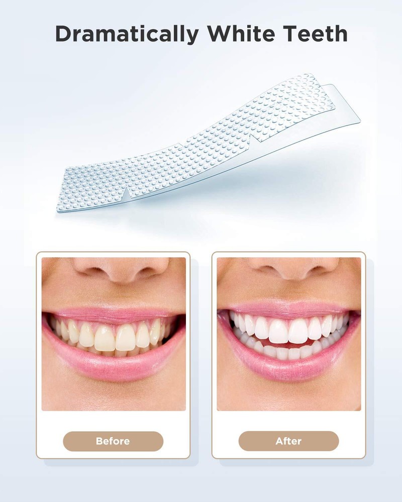 Fairywill 28 Advanced Teeth Whitening Strips Mint Pro Low Sensitivity Ingredient