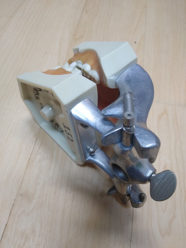 Columbia Dental Typodont Teeth Model R861 with Removable Teeth (missing 5 teeth)