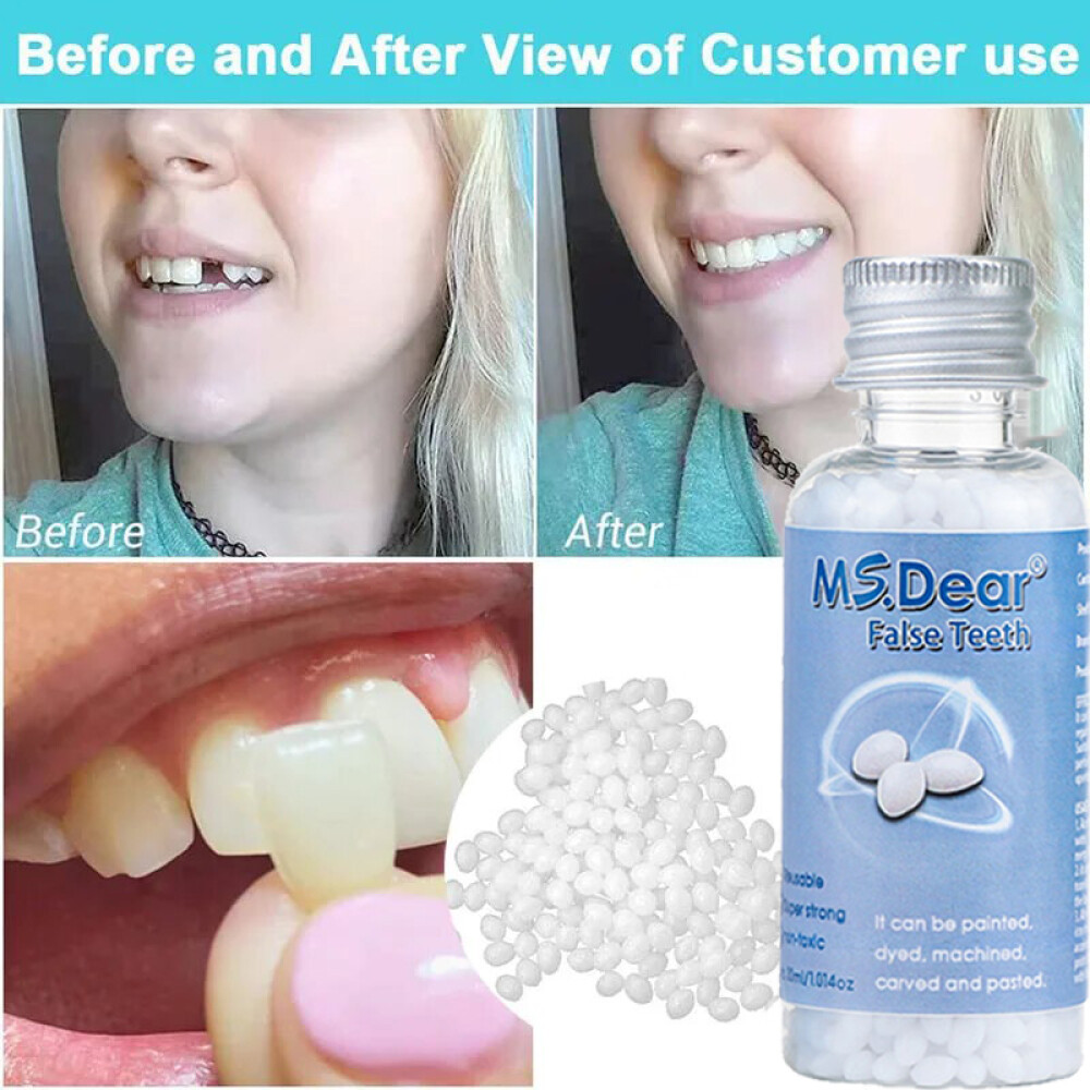 Tooth Repair Granules Temporary Kit Fitting Bead Reusable Moldable False Teeth