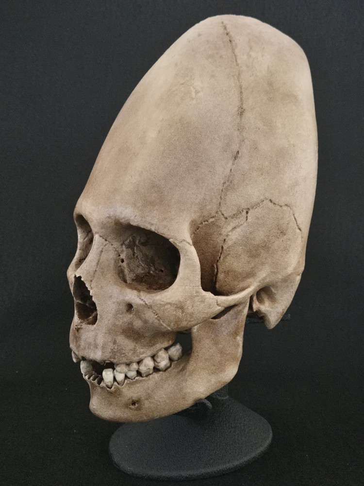 Real Human Skull - Peruvian Enlongated- Hyper Realistic Replica with stand.