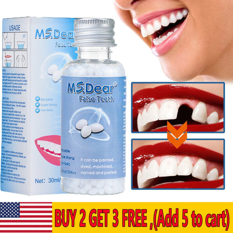 Temporary Tooth Repair Kit Temp Dental Repair Replace Missing Teeth DIY Moldable