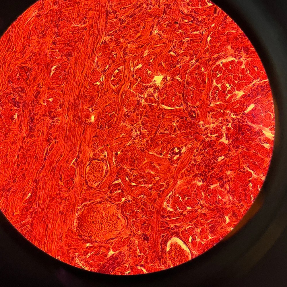 Nikon Eclipse TE200 Inverted Microscope Fluorescence Hoffman Constrast