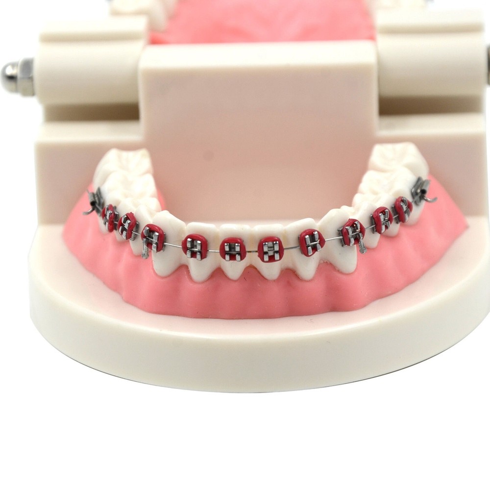 Dental Teach Typodont Demonstration Teeth Model with Braces For Patient Study
