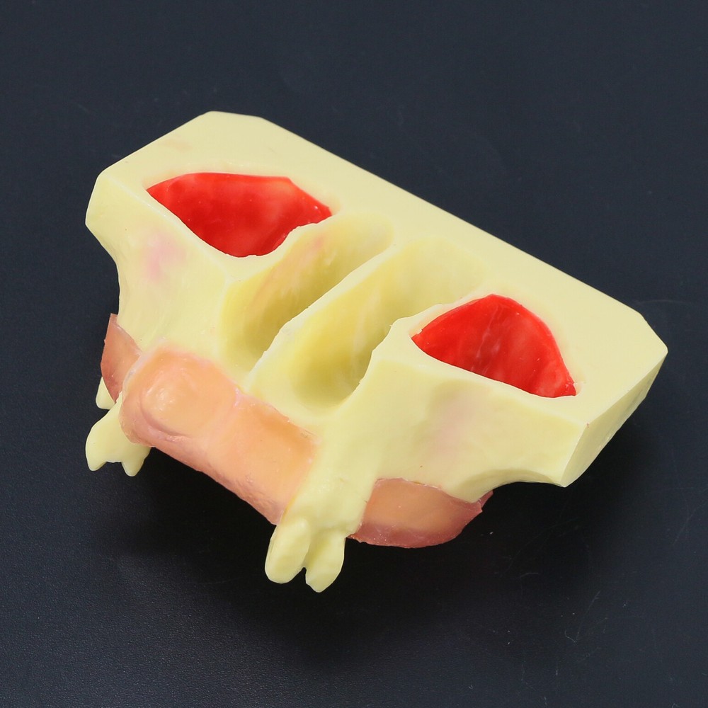 Dental Typodont Teeth Model Sinus Lift Practice Study Teach Demo Model 2012 2013
