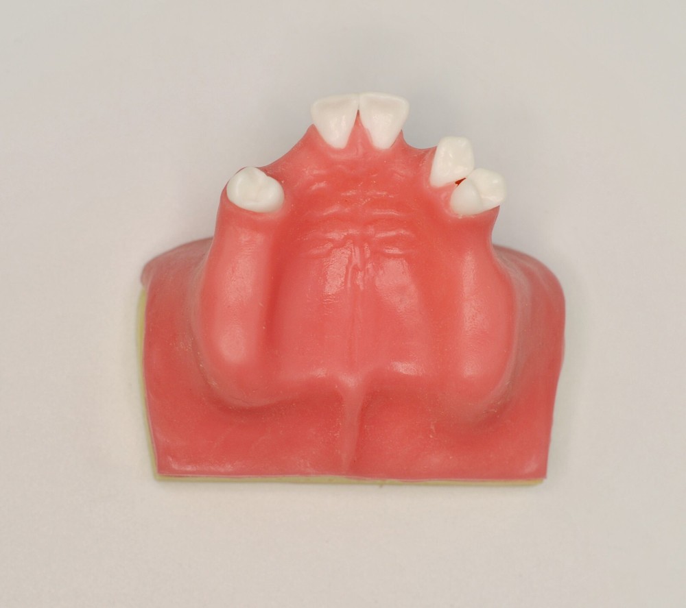 Dental Implant Model Maxillary Sinus Jaw Lift Practice Study Teeth Training