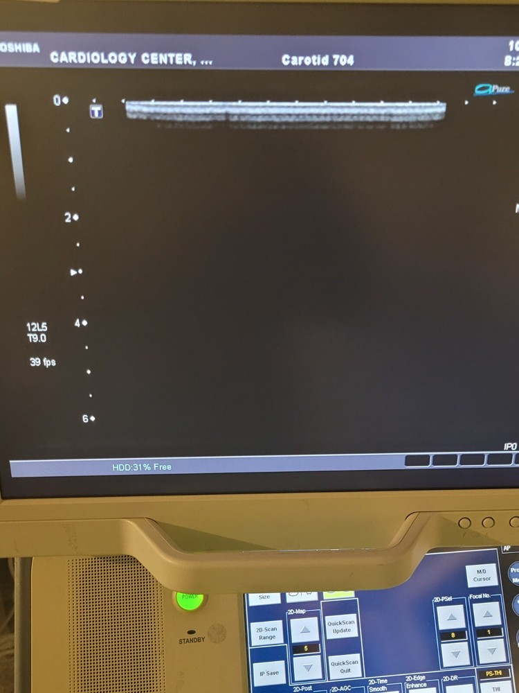 Toshiba PLT-805AT Linear Array Ultrasound Transducer Probe