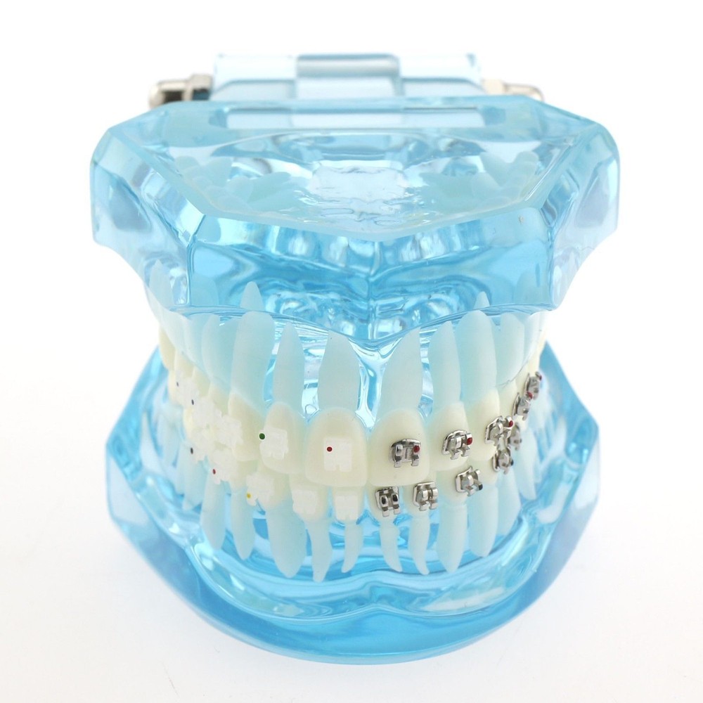 Dental Teach Study Typodont Teeth Model Half Metal Bracket Half Ceramic Bracket