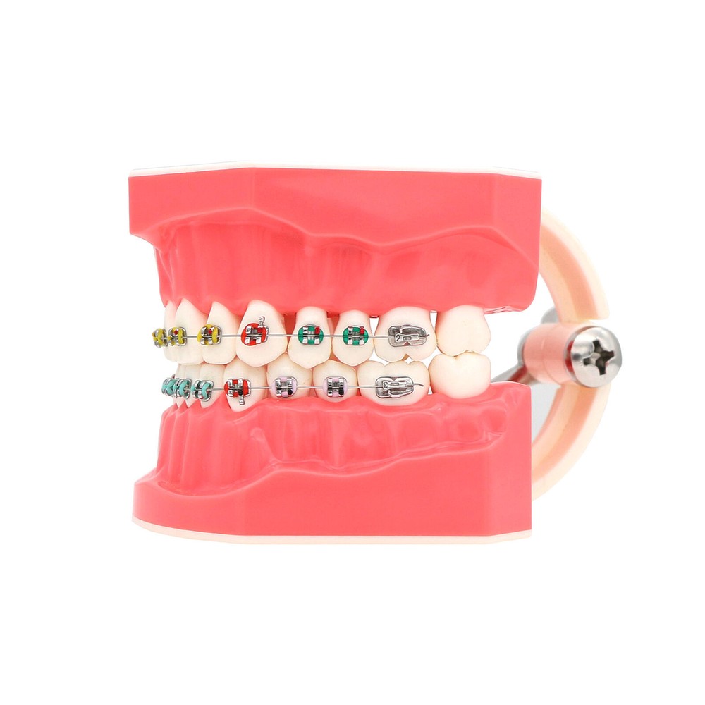 1:1 Dental Teach Study Typodont Teeth Model With Metal Ceramic Brackets Tubes