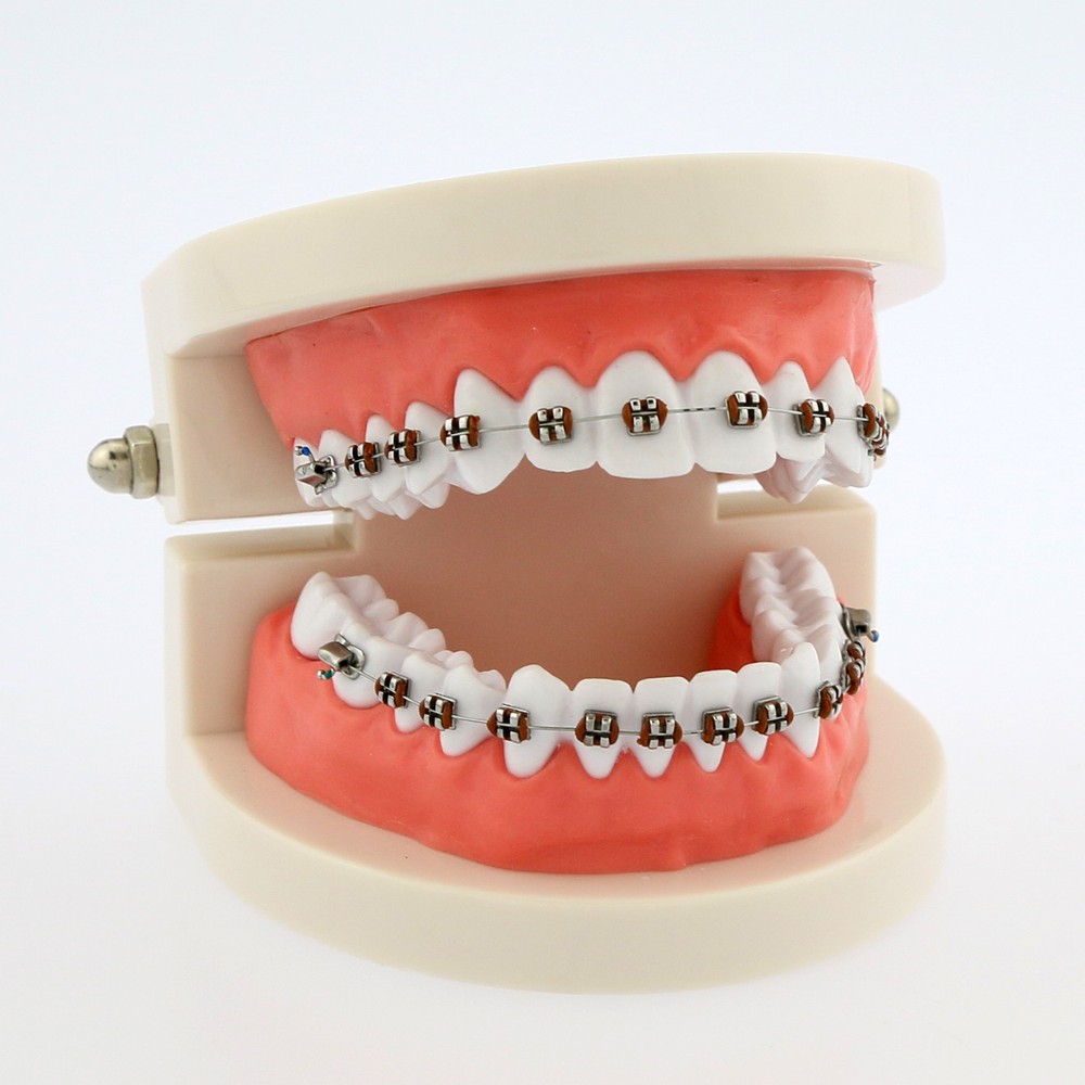 Dental Teach Typodont Demonstration Teeth Model with Braces For Patient Studying
