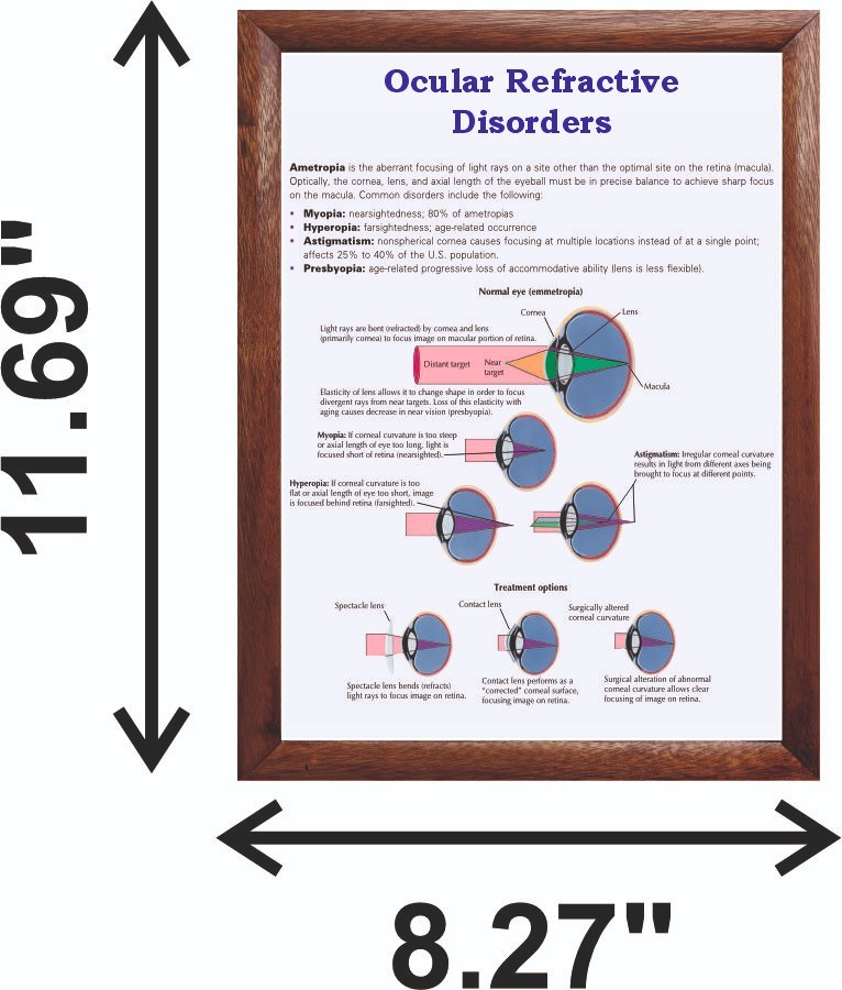 Ocular Refractive Disorders Chart 12x18 inches