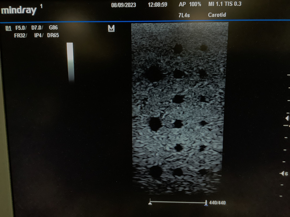 2013 Mindray 7L4s Linear Array Ultrasound Probe