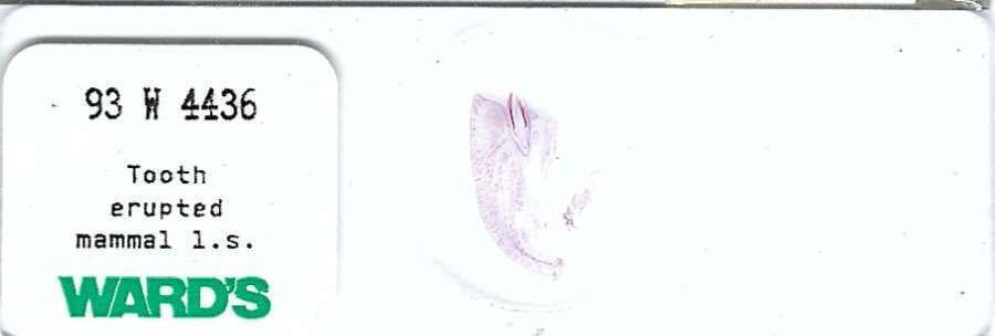 Mammalian Erupted Tooth Microscope Slide