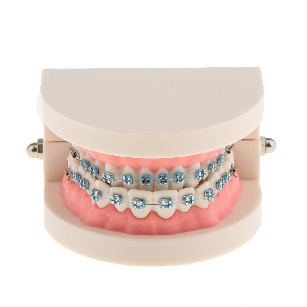Dental Teach Typodont Demonstration Teeth Model with Braces For Patient Study