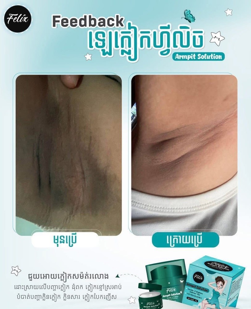 Felix Armpit Solution Cream លេលាបក្លៀកសរ ( 18g )