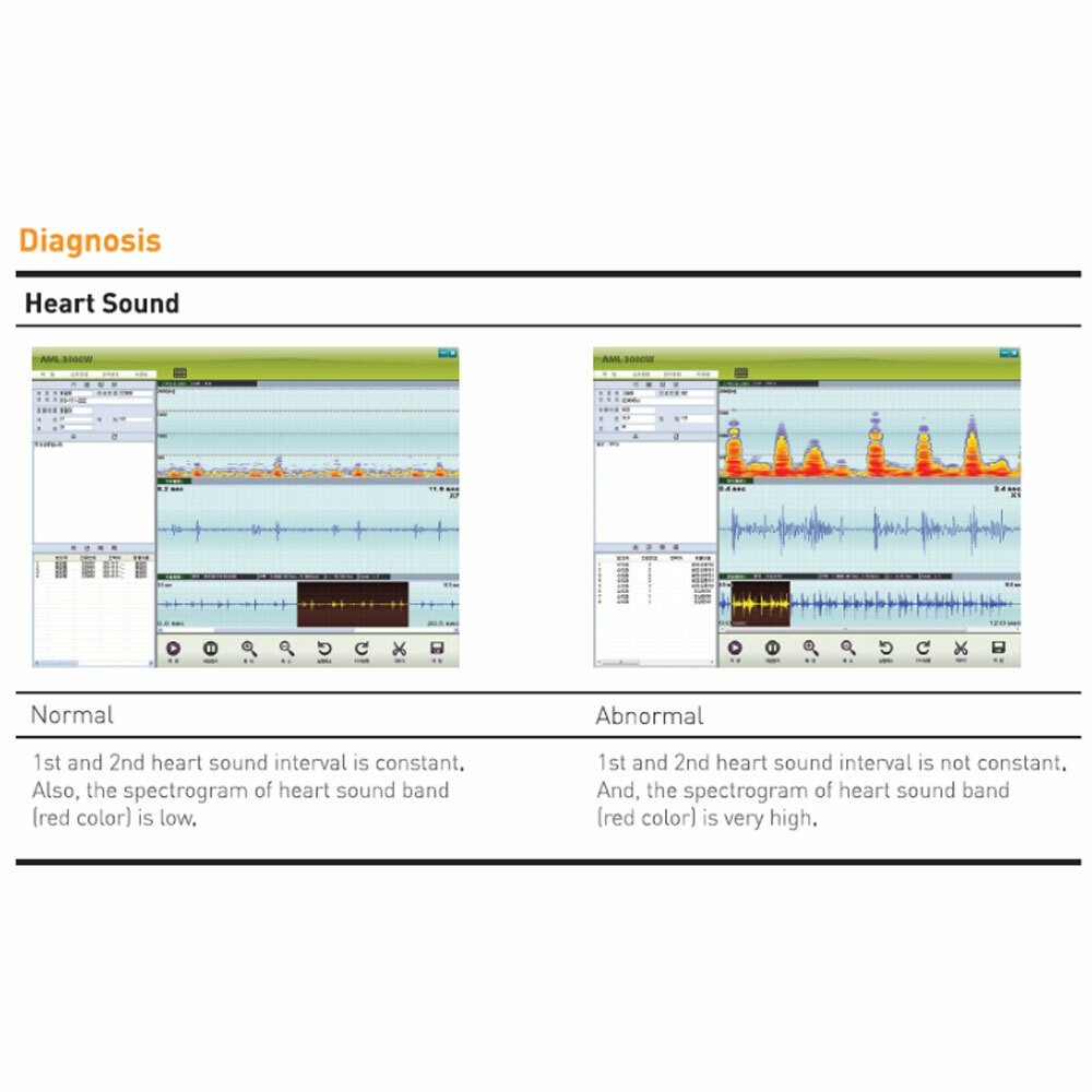 Sunmeditec Animal Wireless Digital Stethoscope
