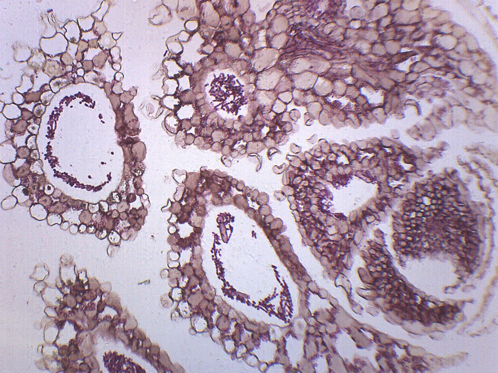 Anabaena - Prepared Microscope Slide - 75x25mm - Eisco Labs
