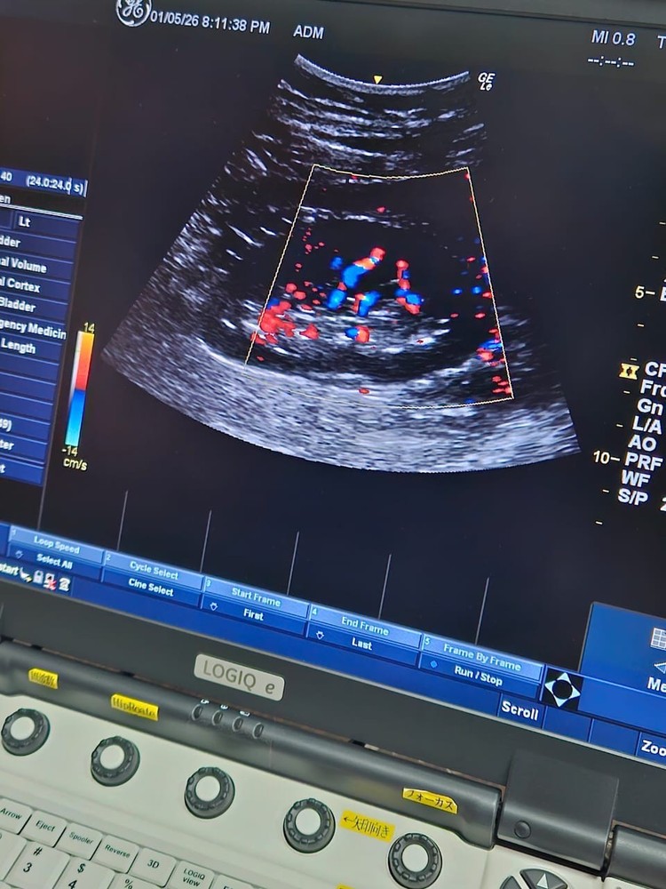 GE Convex Probe 4C-RS