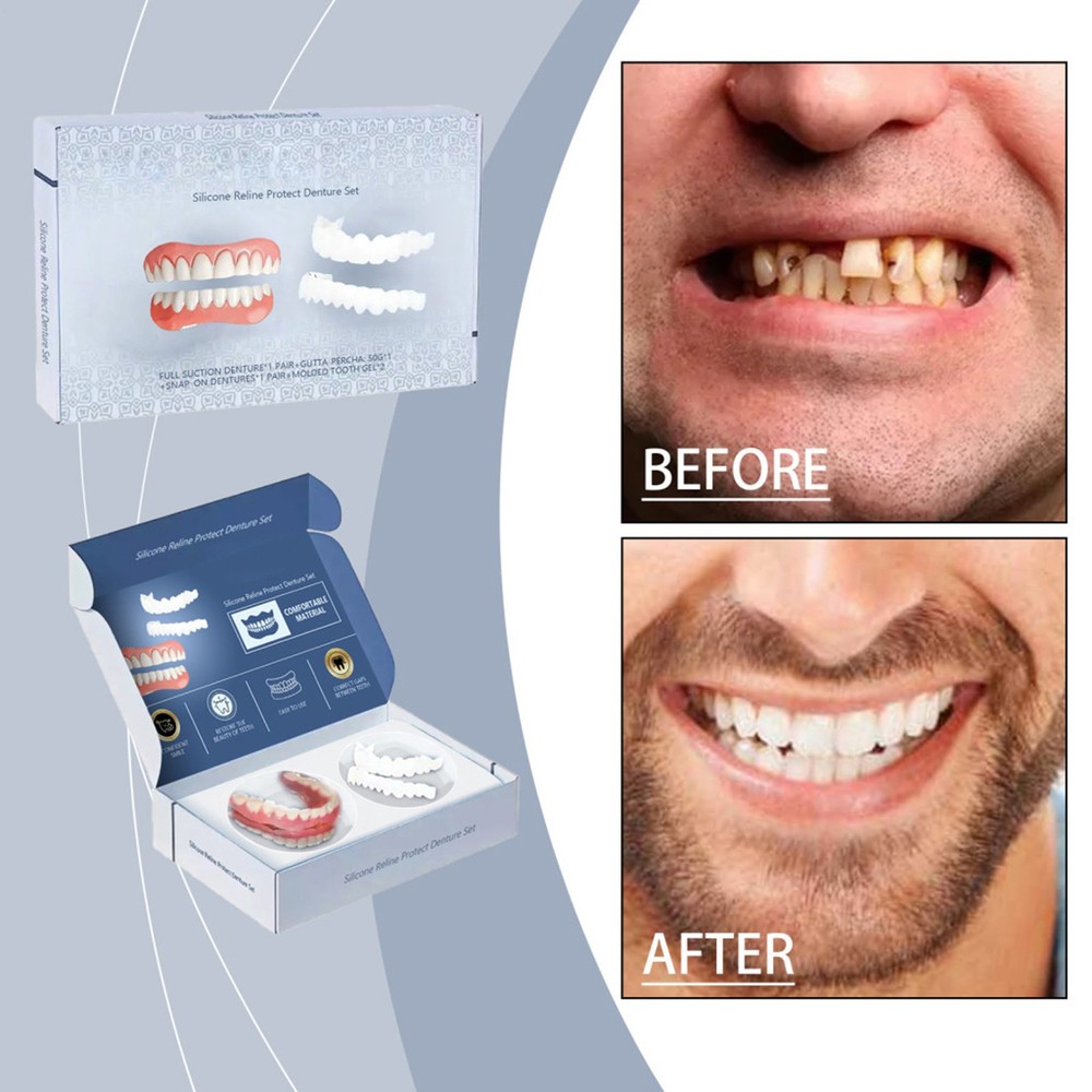 Easy Denture Top and Bottom Denture Solution Improve Smile Denture Full Set