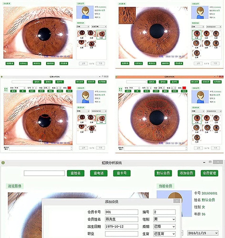Iridology Camera Iriscope Iris Analyzer Iridology Camera with English Software