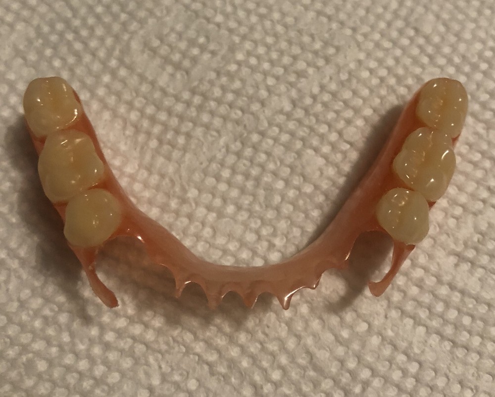 BURBANK Replacement DentalLab Partials Lower Side 6 teeth CustomMadeMissingTooth