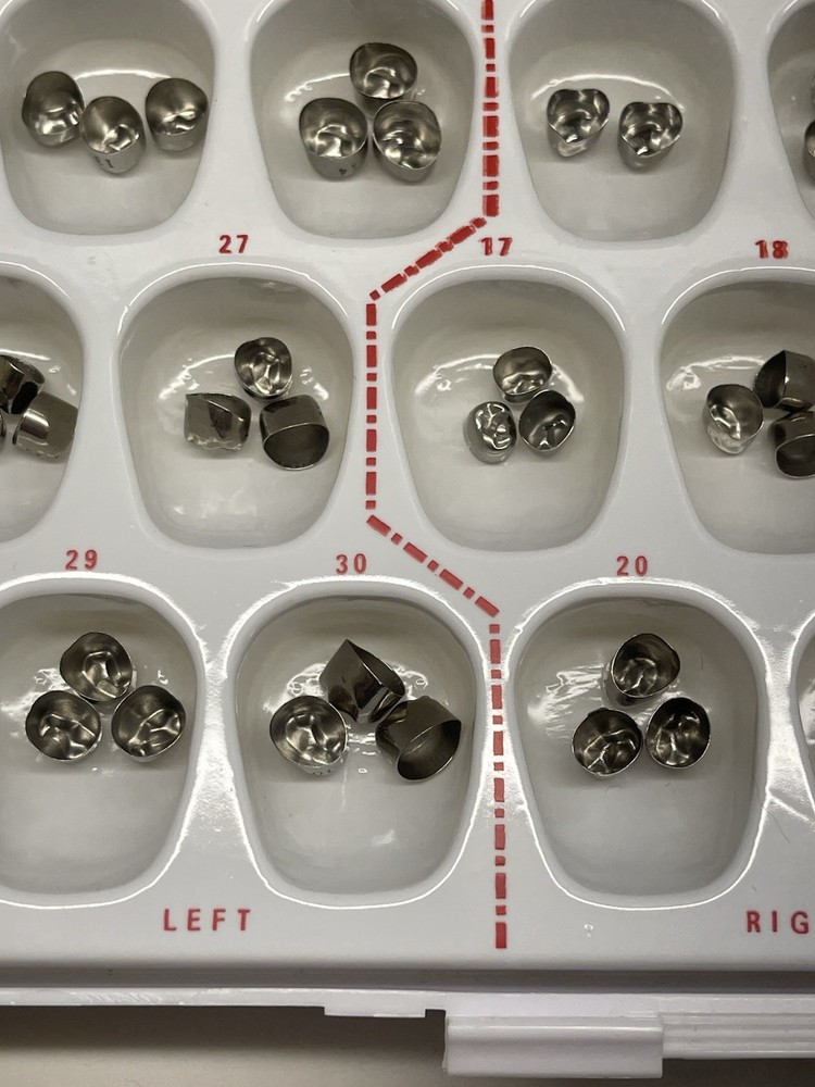 First Primary Molar Crowns by Rugby Labs