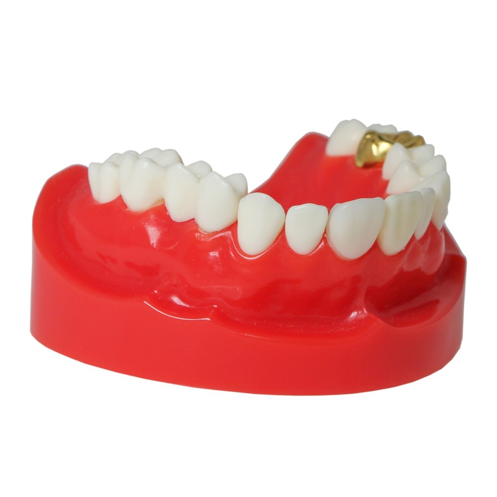 Dental Teaching Typodont Teeth Restoration Model Crown Post Core Bridge M6004