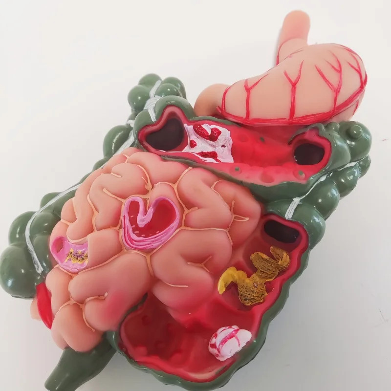 Removerable Human Stomach Anatomy Model Pathological Digestive System Model