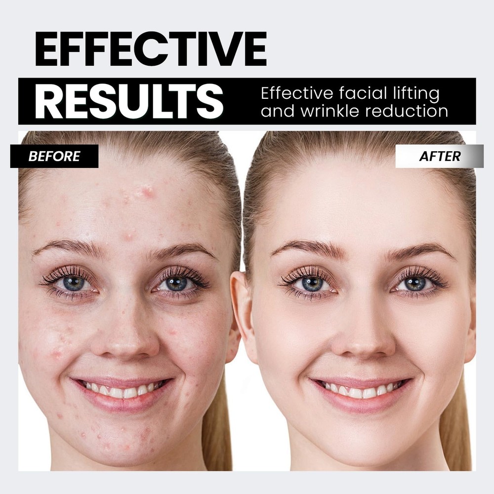 Microcurrent Facial Device,Latest Red Light Technology,Enhances The Ability t...