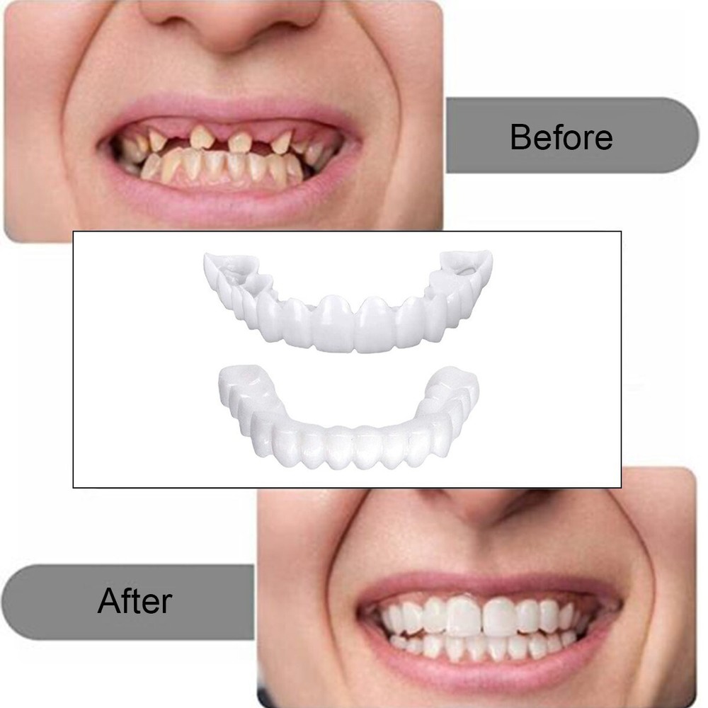 Snap On Veneers Upper & Lower Set - Instant False Teeth Covers No Adhesive buym