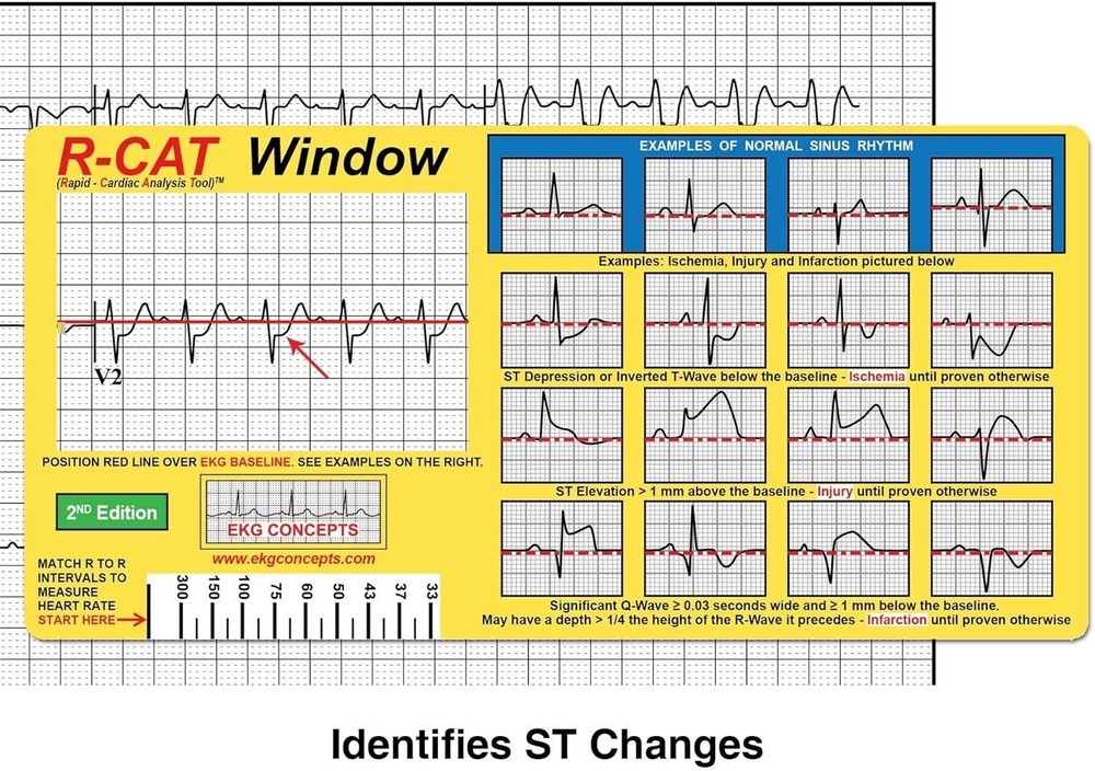 EKG Window 2nd Edition