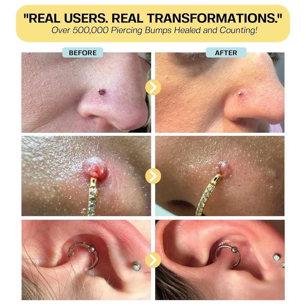 Base Laboratories Piercing Bump Solution & Keloid Bump Removal | Sooth 0.5 oz