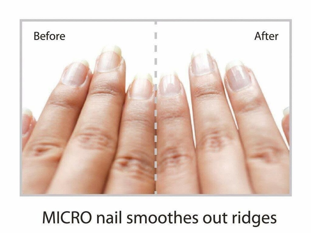 Emjoi Micro Nail Buffer, Trimmer and Filing Replacement Rollers - Set of 4