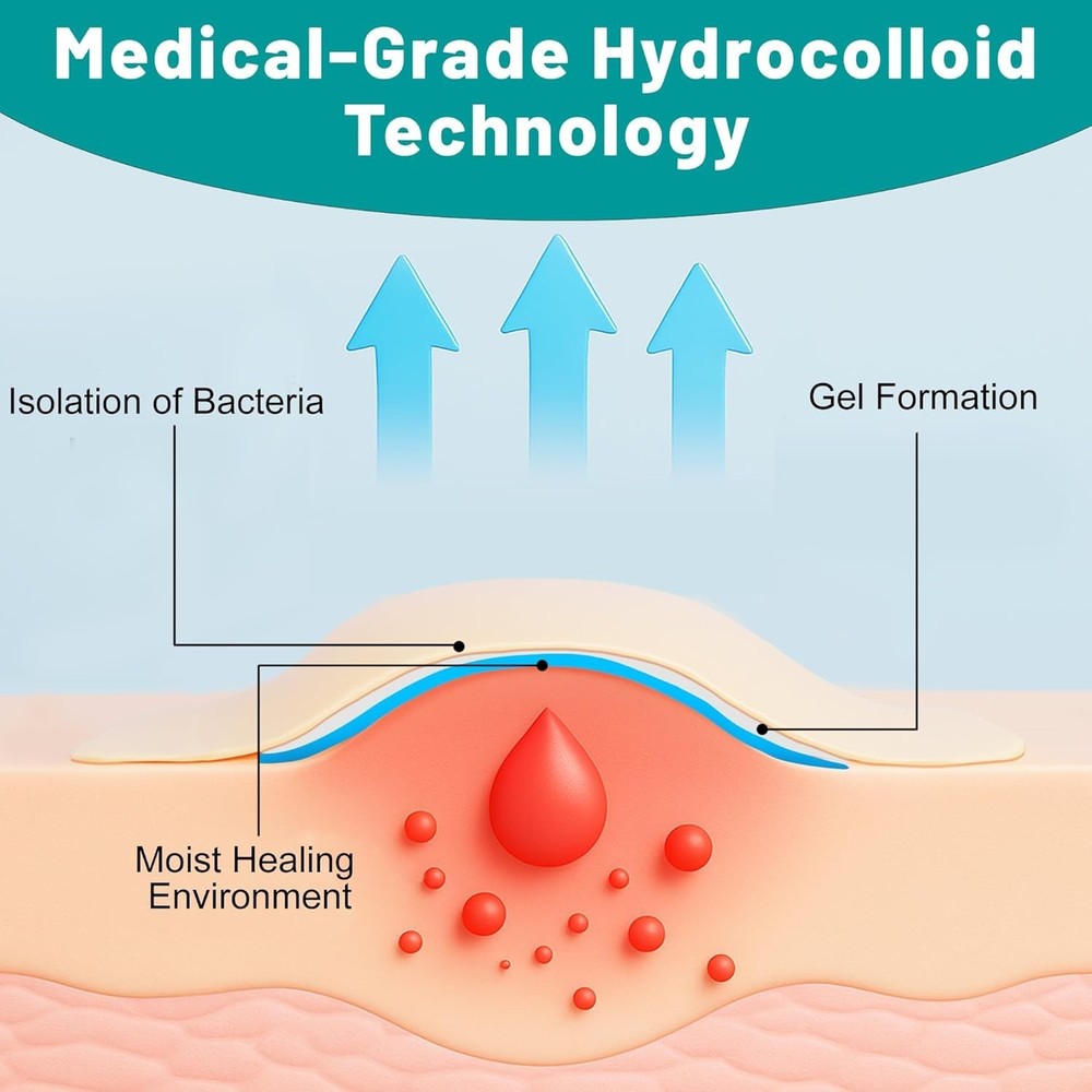 Hydrocolloid Roll, Extra Large Hydrocolloid Bandages, Pimple Patch Roll for Acne