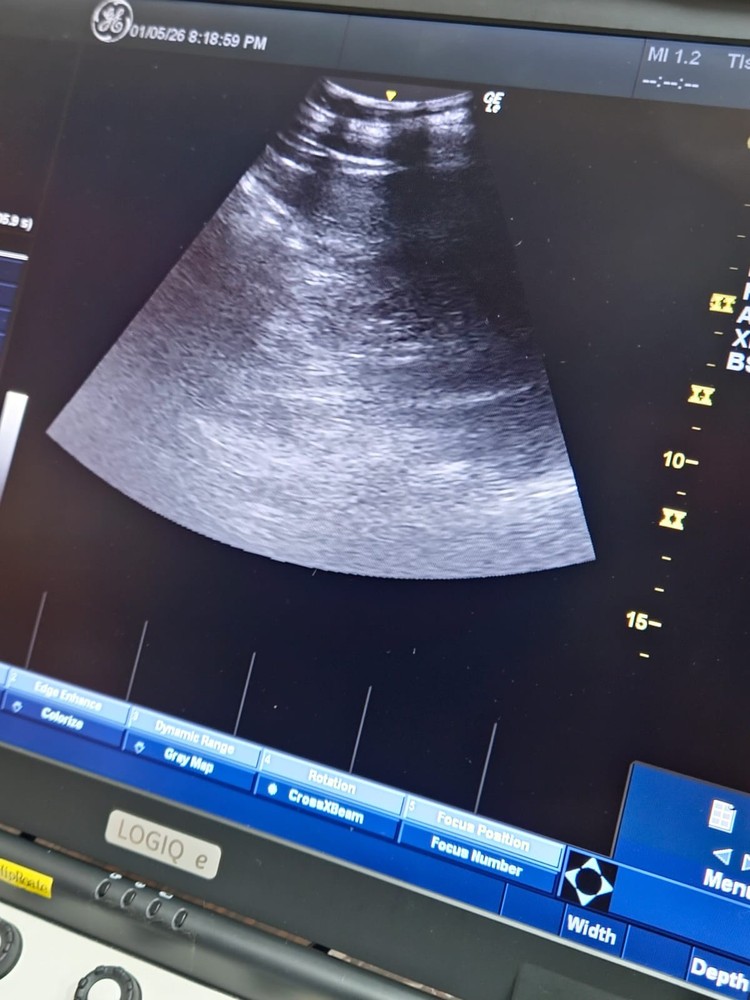 GE 4C-RS Convex Transducer with Shadow