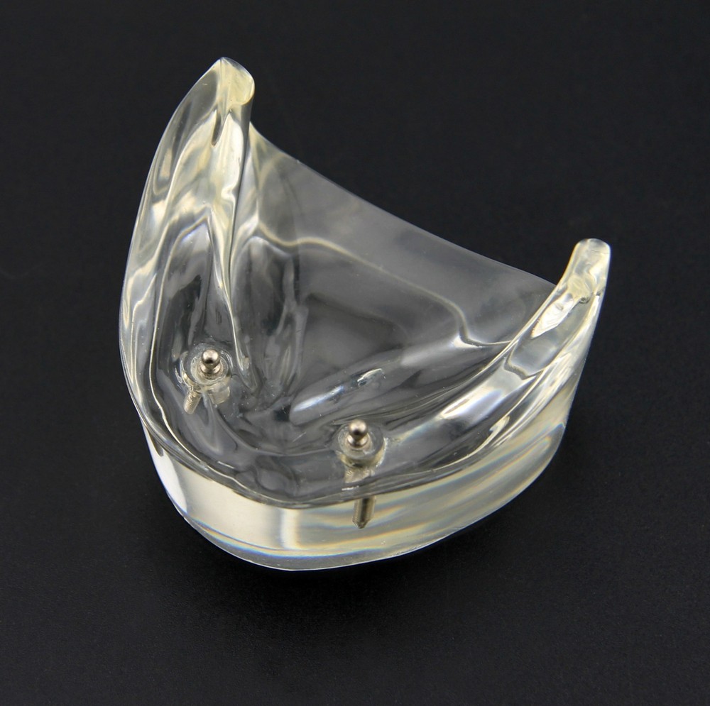 Dental Inferior Overdenture Anatomical Model Teeth Typodont Lower Jaw 2 Implants