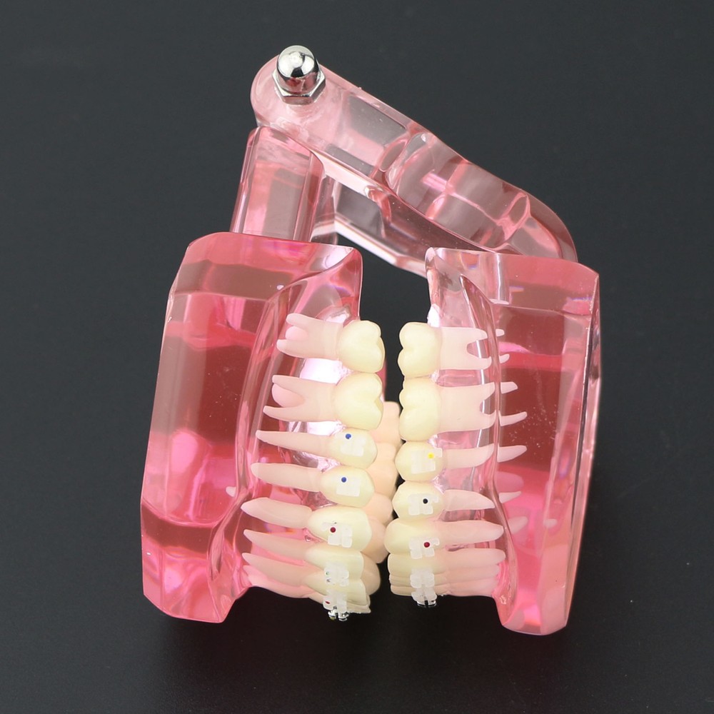 Dental Orthodontic Teeth Model Metal and Ceramic Bracket Study Teach Model 3003