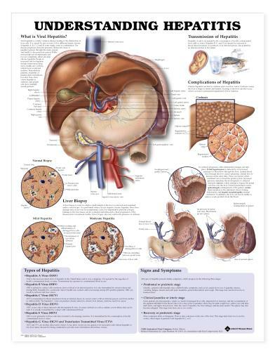 HEPATITIS  Laminated Wall Chart 20" x 26" Classroom/Professional LFA #99992