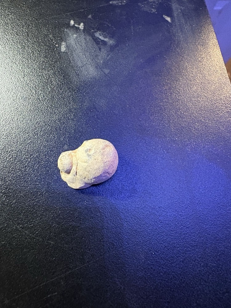Dug Civil War Relic