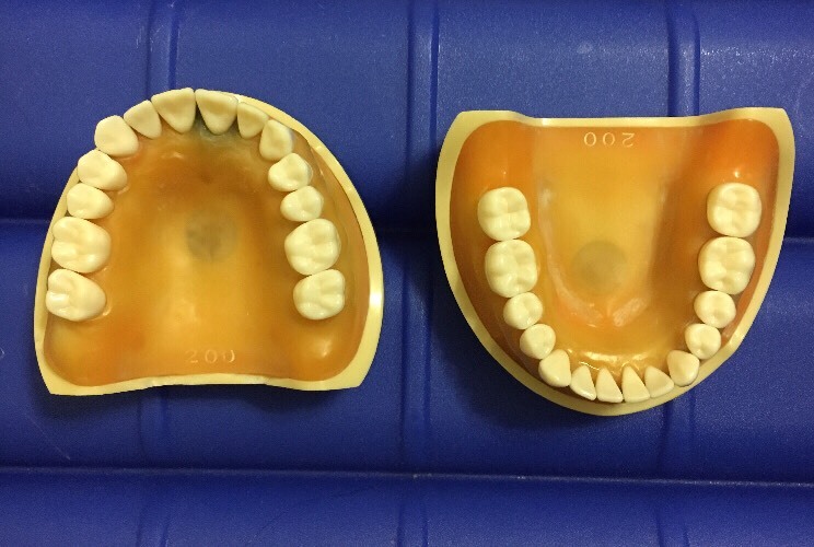 Kilgore Missing Typodont D85S TRM 620
