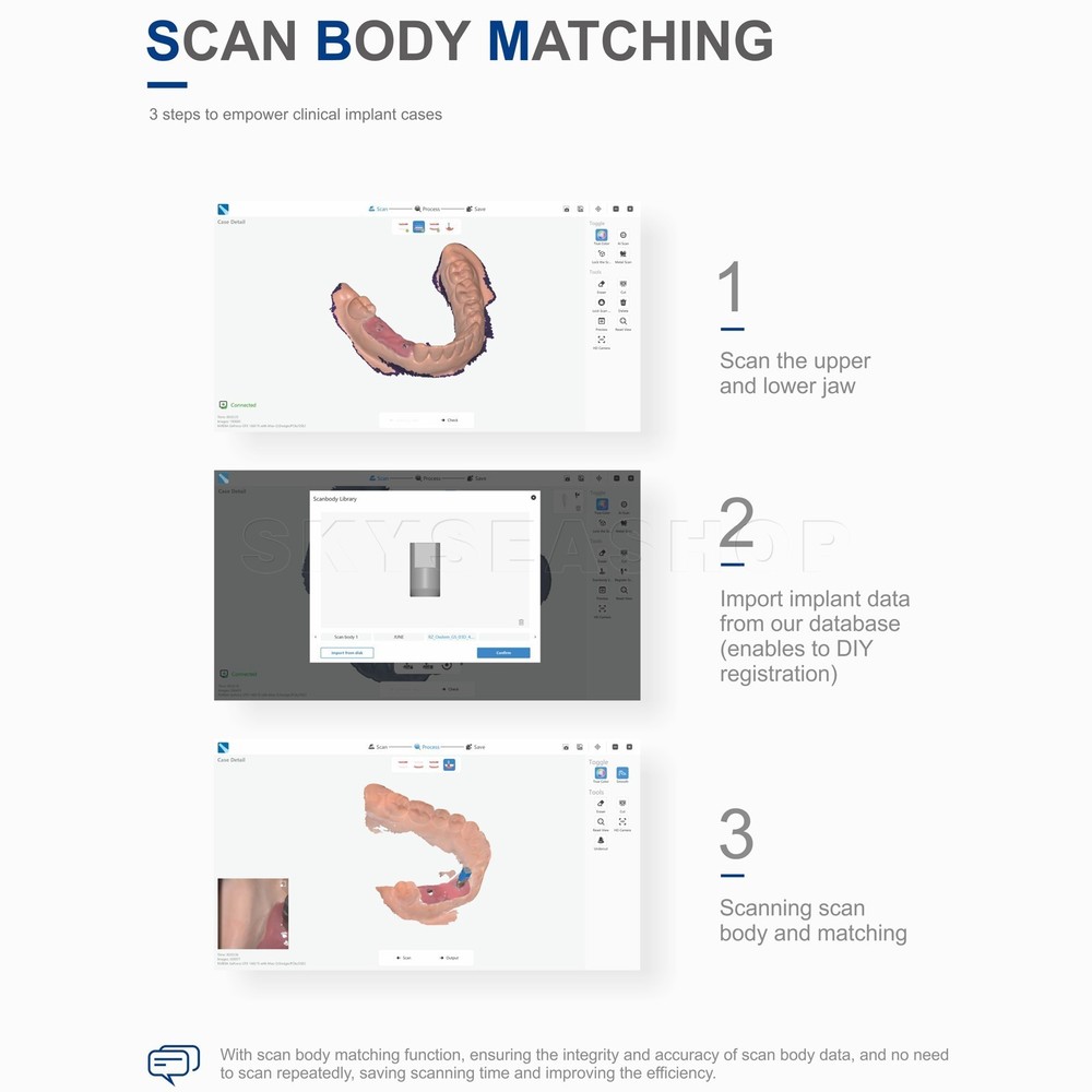 Dentistry Intraoral Scanner Solution Dental with Software