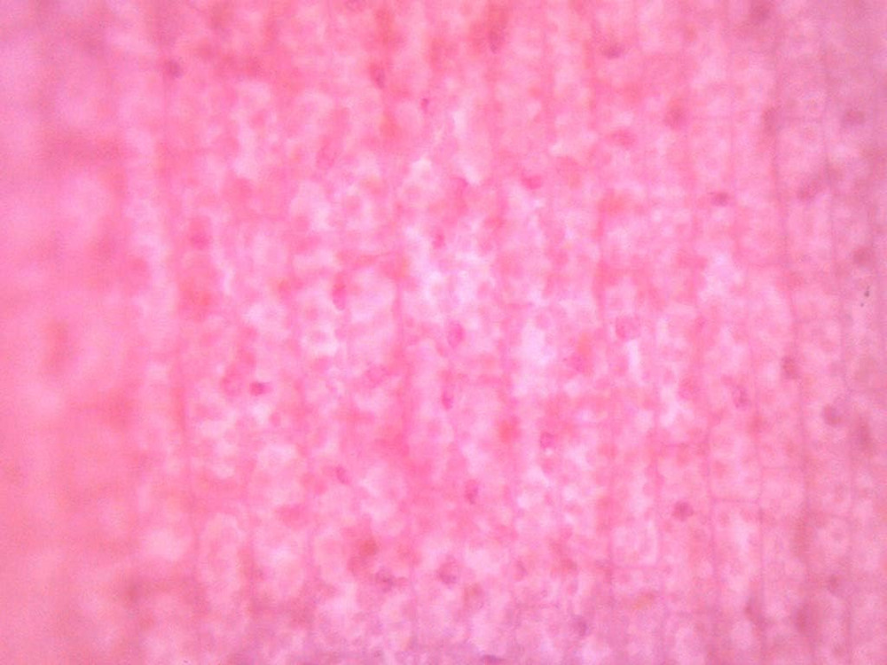 Elodea, Submerged Leaf - Prepared Microscope Slide - 75 X 25Mm - Microscopy