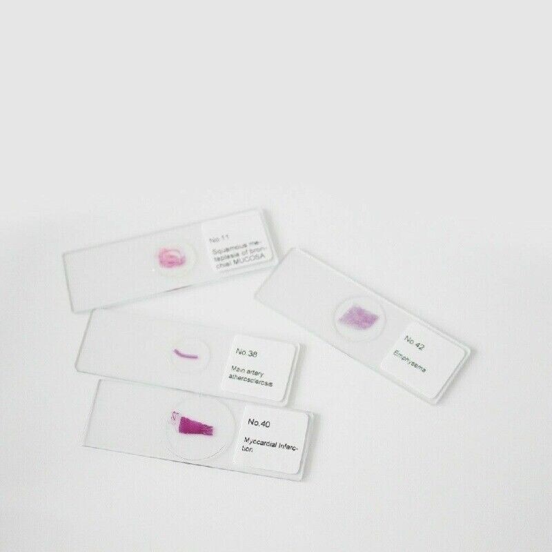 100PCS Mammal Pathological Section Typical Prepared Specimen Slides