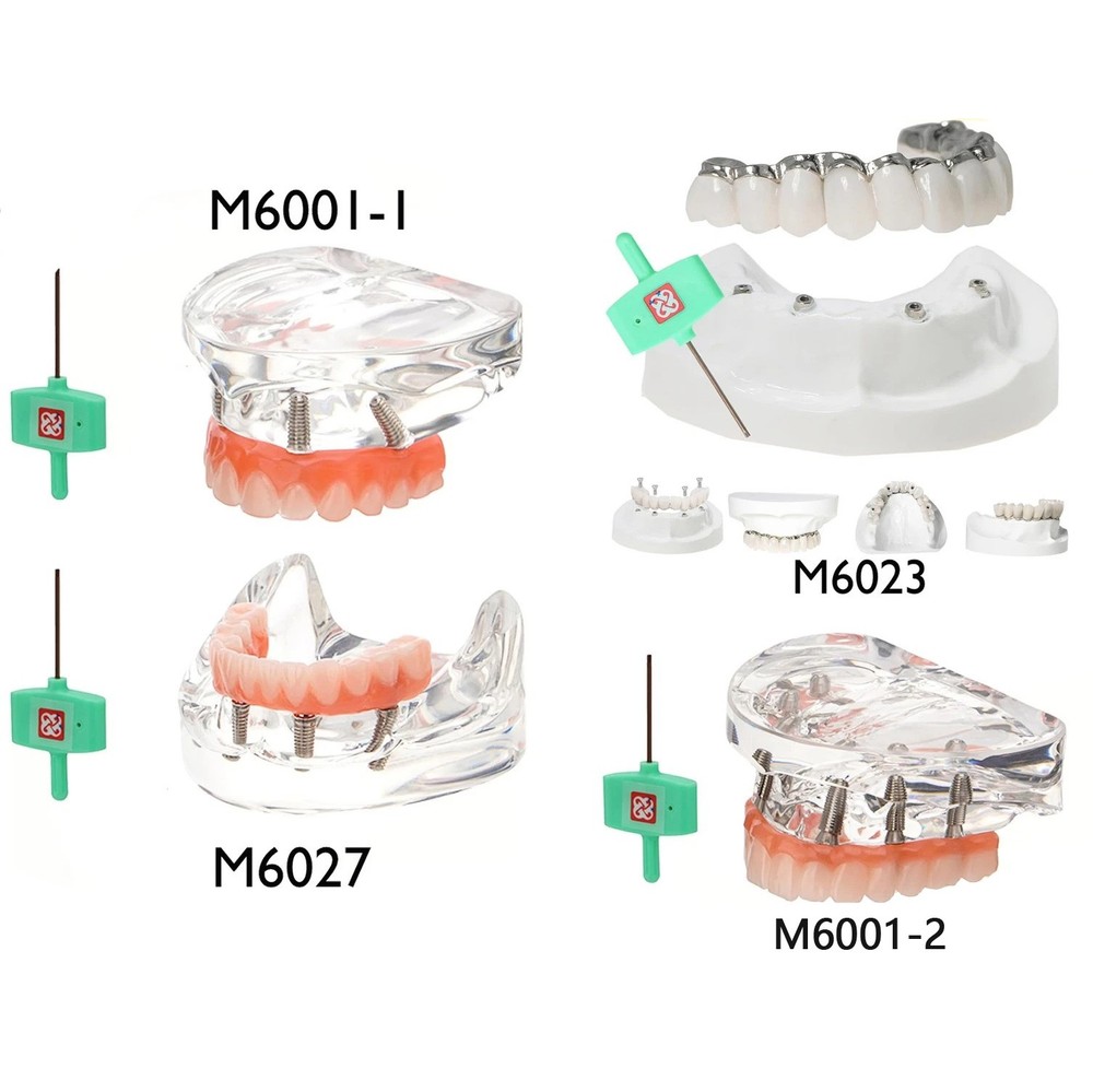 Dental Teeth Model Dental Implant Model Teeth Restoration Model Upper&Lower Jaw