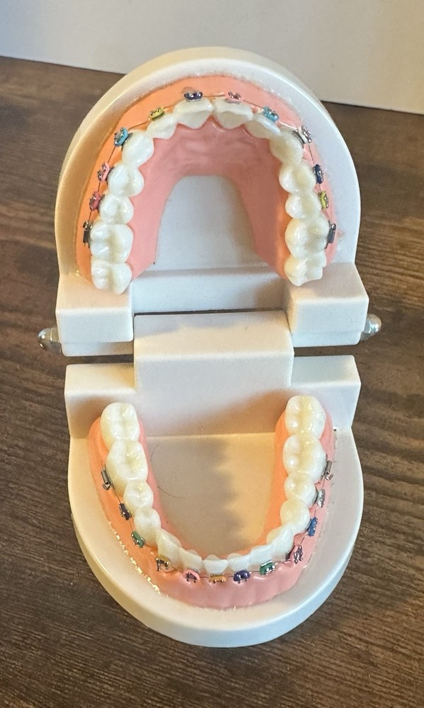Dental Typodont Orthodontic Treatment Teeth Model Malocclusion Study w/ Braces