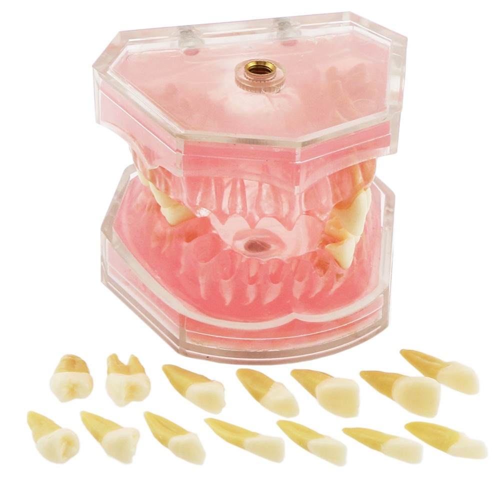 M7008 Standard Dental Study Teeth Model with Soft Gingiva 28 Removable Teeth