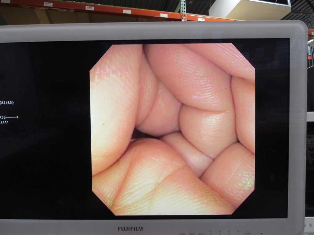 Olympus CF-140S Sigmoidoscope Endoscopy Endoscope