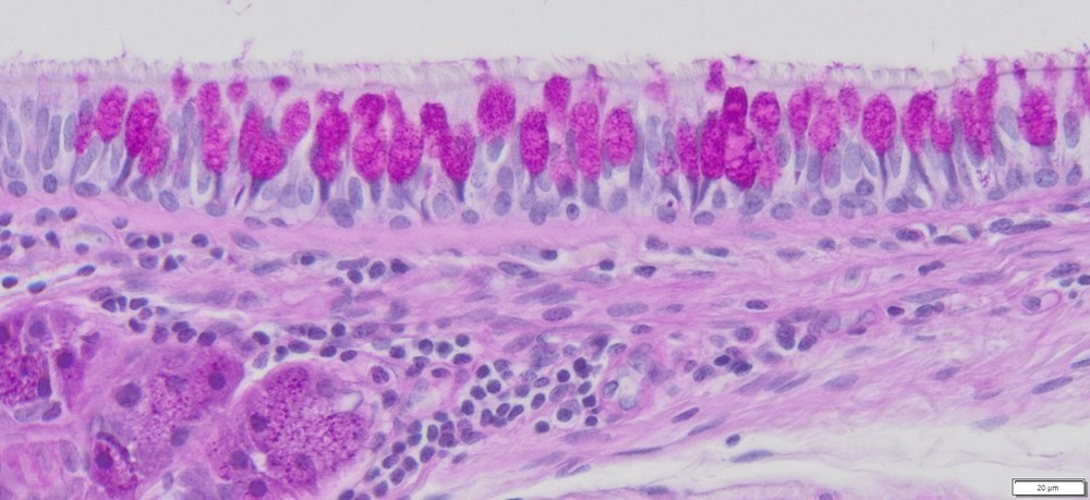 VitroView™ PAS Stain Kit (Cat#VB-3004)