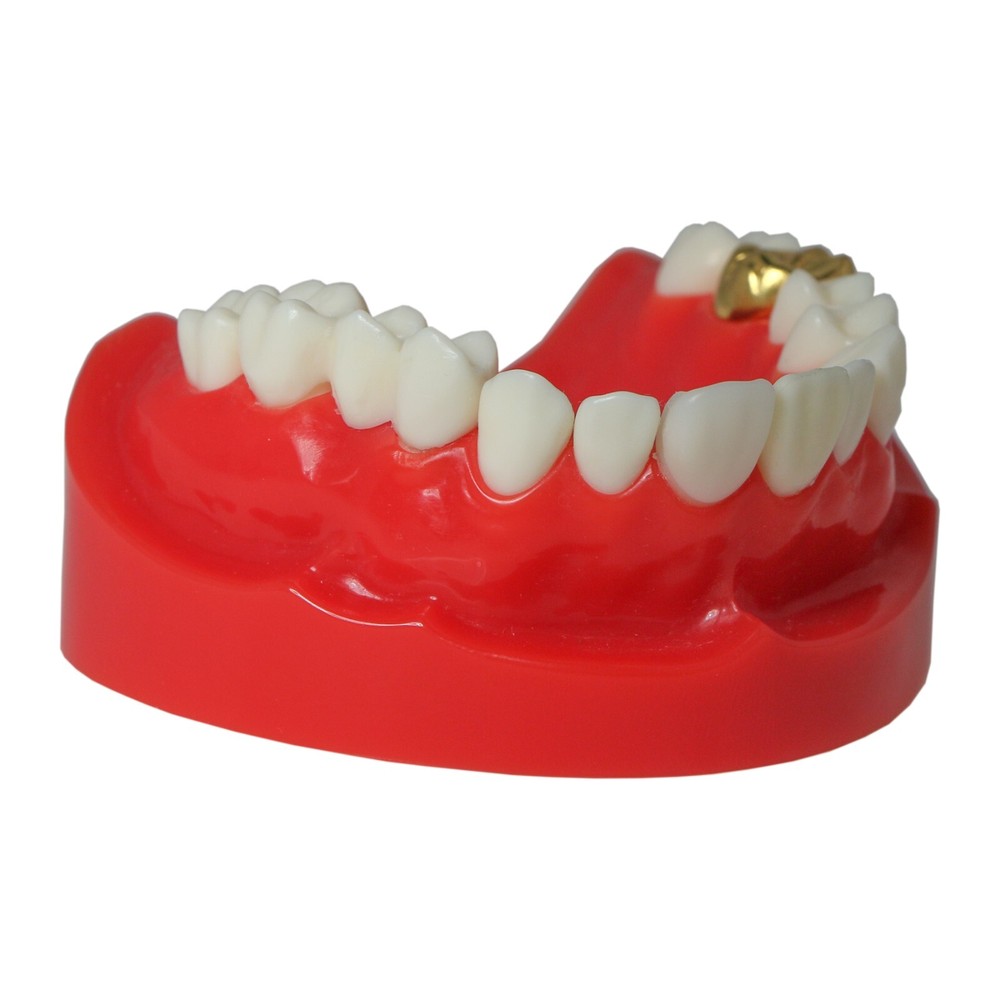 Dental Typodont Teaching Restoration Teeth Model Crown Post Core Bridge M6004
