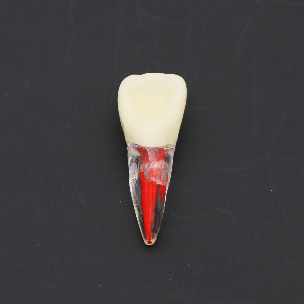 Dental Root Canal RCT Block Pulp Cavity Practice Model for Endo File Study Teeth